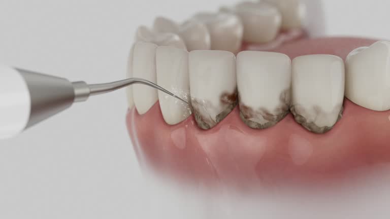 Reliable Tooth Extraction contractor in Rockdale County County, GA by Dentist Open Now